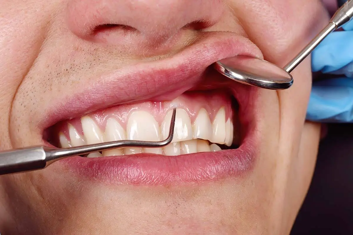 Close-up periodontal examination of a patient’s gums and teeth